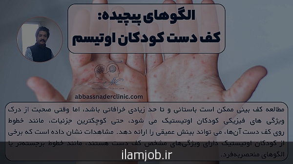 بچه های اوتیسم